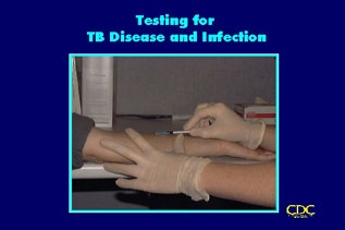 tuberculosis poster