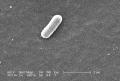 A microscopic view of the e. coli bacteria